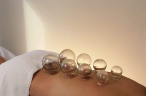 cupping healing technique